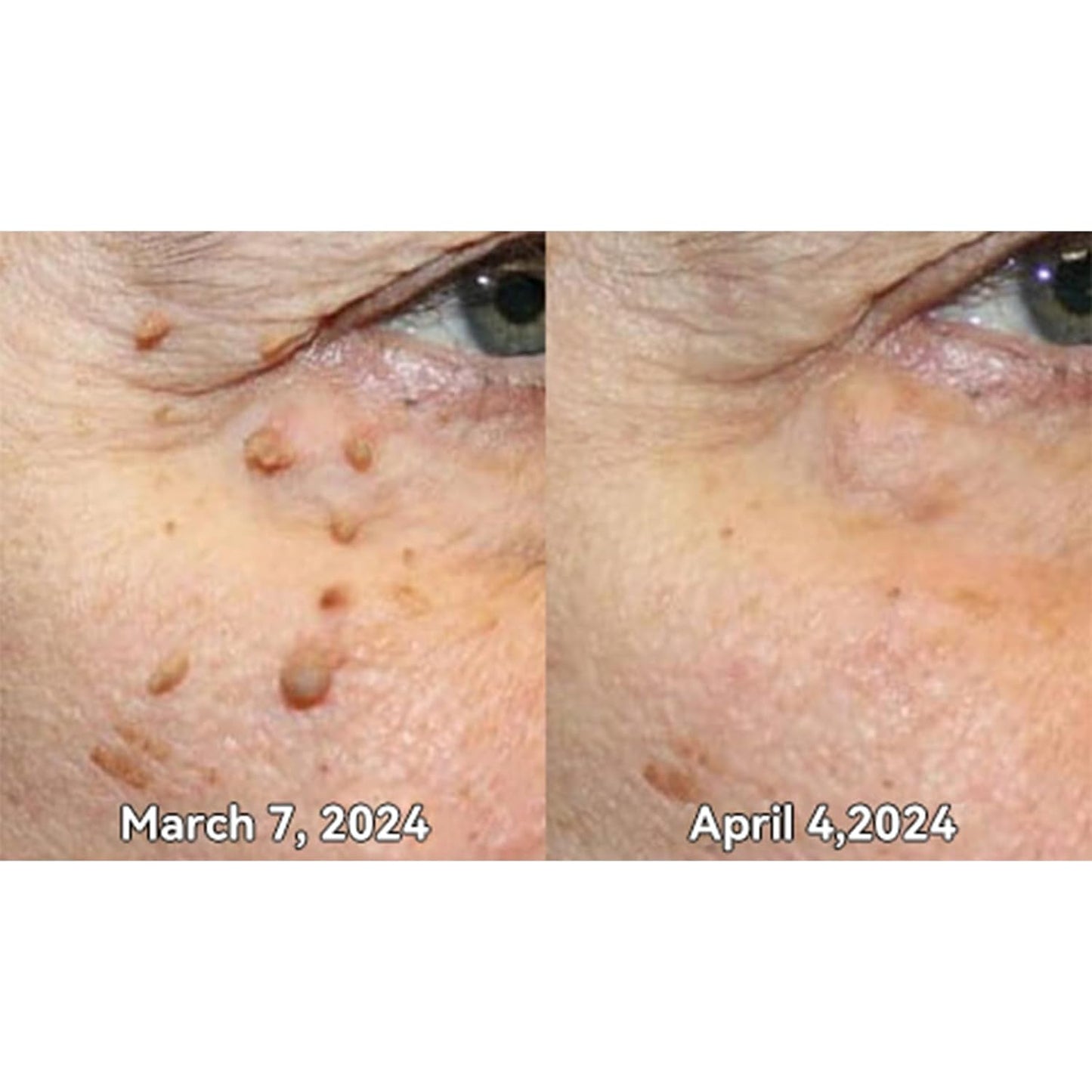 Paga 1 y llévate 2 – Promoción RELÁMPAGO solo por HOY - 🚚 ¡Paga al recibir!